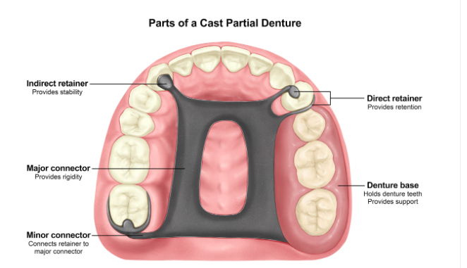2026 INBDE bootcamp, remember questions and more